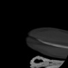 SPORK, NICO - 22.03.1976 - 02.08.2022 - CT obere Extremität - 17:59:38